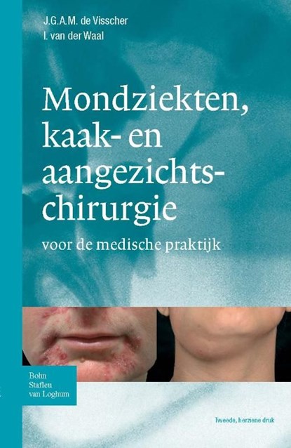 Zakboek mondziekten, kaak- en aangezichtchirurgie, Jan GAM de Visscher ; Isaac van der Waal - Ebook - 9789031364831