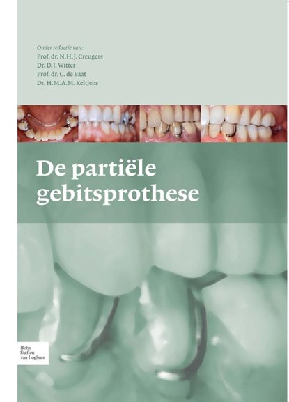 De partiele gebitsprothese, N.H.J. Creugers ; D.J. Witter ; C. de Baat ; H.M.A.M. Keltjens - Gebonden - 9789031375752