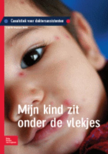 Mijn kind zit onder de vlekjes, S. van der Krogt ; A. Starink - Paperback - 9789031378982