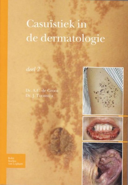 Casuïstiek in de dermatologie, Johan Toonstra ; A.C. Groot - Paperback - 9789031384570