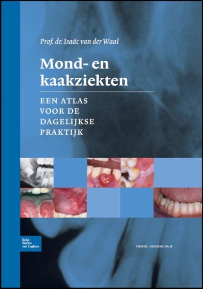 Mond- en kaakziekten, Isaac van der Waal ; I. van der Waal - Gebonden - 9789031386093