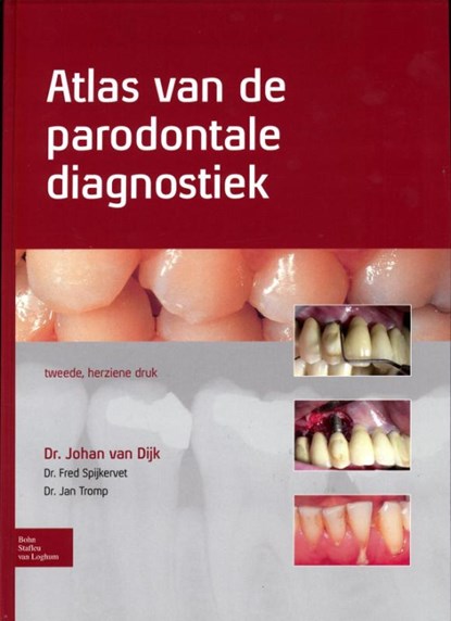 Atlas van de parodontale diagnostiek, Johan van Dijk ; Fred Spijkervet ; Jan Tromp - Gebonden - 9789031388097
