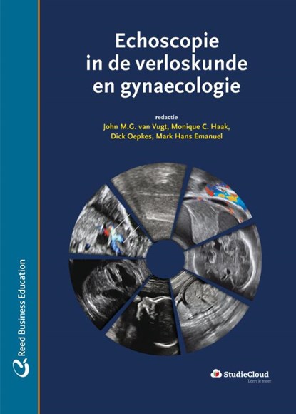 Echoscopie in de verloskunde en gynaecologie, J.M.G. van Vugt - Gebonden - 9789035233973