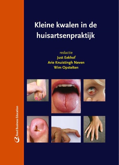 Kleine kwalen in de huisartsenpraktijk, J.A.H. Eekhof ; Arie Knuistingh Neven ; Wim Opstelten - Gebonden - 9789035235595