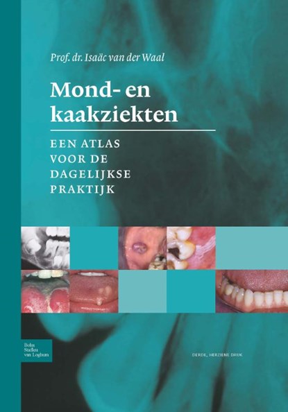 Mond- en kaakziekten, Isaac van der Waal - Gebonden - 9789036808330