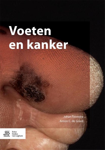Voeten en kanker, Johan Toonstra ; Anton C. de Groot - Paperback - 9789036810708