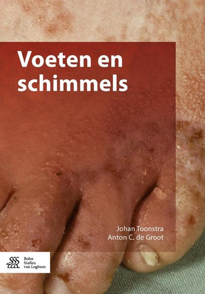 Voeten en schimmels, Johan Toonstra ; Anton C. de Groot - Paperback - 9789036811682