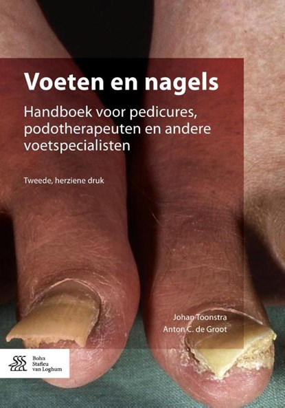 Voeten en nagels, Johan Toonstra ; Anton de Groot - Paperback - 9789036813174