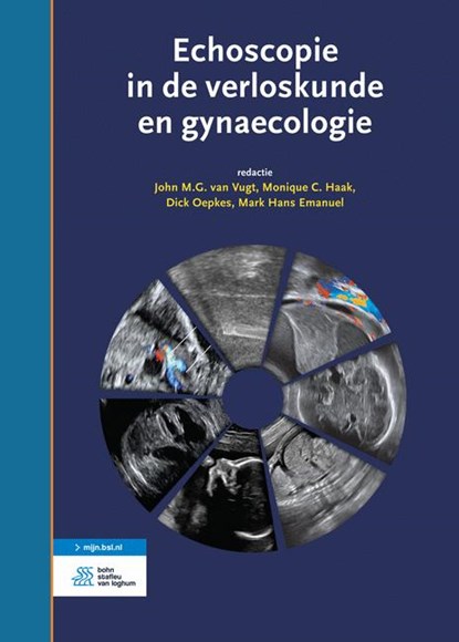 Echoscopie in de verloskunde en gynaecologie, J.M.G. van Vugt ; Monique Haak - Gebonden - 9789036814508