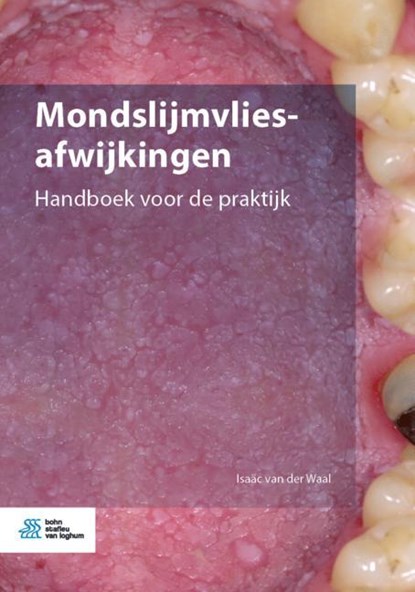 Mondslijmvliesafwijkingen, Isaäc van der Waal - Paperback - 9789036824019