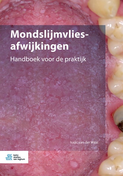 Mondslijmvliesafwijkingen, Isaäc van der Waal - Ebook EPUB - 9789036824026