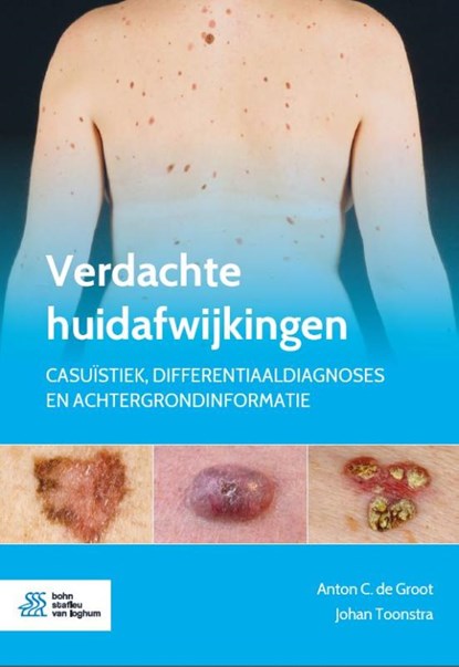 Verdachte huidafwijkingen, Anton  C. de Groot ; Johan Toonstra - Paperback - 9789036824668