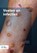 Voeten en infecties, Johan Toonstra ; Anton de Groot - Paperback - 9789036829168