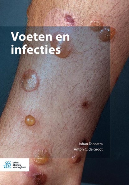 Voeten en infecties, Johan Toonstra ; Anton de Groot - Paperback - 9789036829168