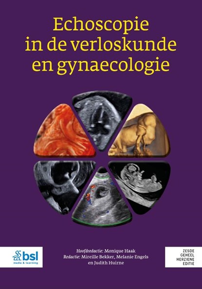 Echoscopie in de verloskunde en gynaecologie, Monique Haak ; Mireille Bekker ; Melanie Engels ; Judith Huirne - Gebonden - 9789036830348