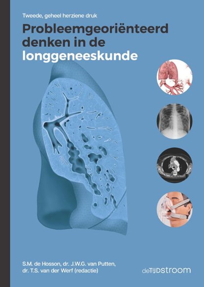 Probleemgeoriënteerd denken in de longgeneeskunde, S.M. de Hosson ; J.W.G. van Putten ; T.S. van der Werf - Paperback - 9789058983206