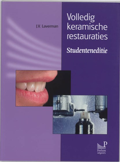 Volledig keramische restauraties Studenteneditie, J.V. Laverman - Paperback - 9789085620488