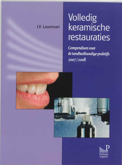 Volledig keramische restauraties, J.V. Laverman - Paperback - 9789085620495