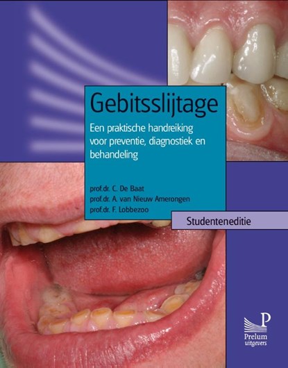 Gebitsslijtage Studenteneditie, C. de Baat ; A. van Nieuw Amerongen ; F. Lobbezoo - Paperback - 9789085620556