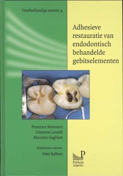 Adhesieve restauratie van endodontisch behandelde gebitselementen, F. Mannocci ; G. Cavalli ; M. Gagliani ; UvA Talen - Gebonden - 9789085620587