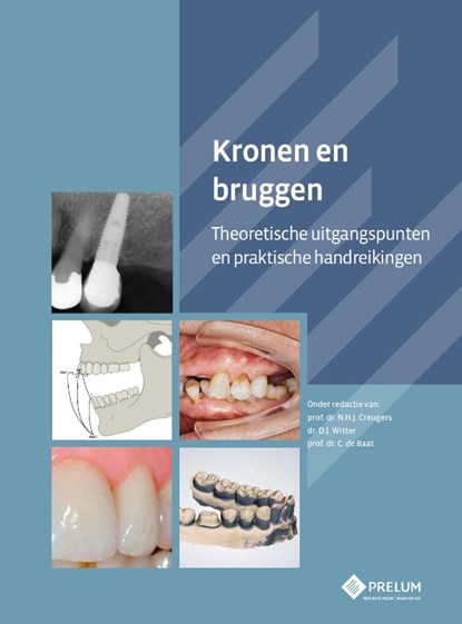 Kronen en bruggen, N.H.J. Creugers ; D.J. Witter ; C. de Baat - Paperback - 9789085621348