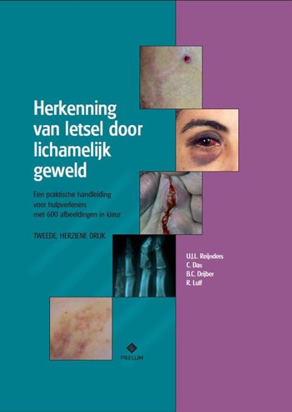 Herkenning van letsel door lichamelijk geweld, U.J.L. Reijnders ; C. Das ; B.C. Drijber ; R. Luif - Paperback - 9789085621553