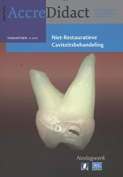 Niet-restauratieve caviteitsbehandeling, R.J.M. Gruythuysen - Paperback - 9789089760999