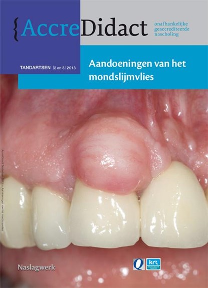 Aandoeningen van het mondslijmvlies, Isaac van der Waal - Paperback - 9789089761224