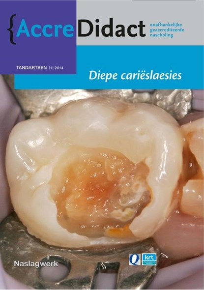 Diepe carieslaesies, R. Gruythuysen ; E. Tijskens ; A.J.P. van Strijp - Paperback - 9789089761460
