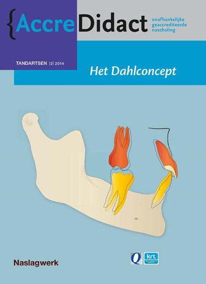 Het dahlconcept, Kya Wabeke - Paperback - 9789089761521