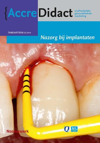 Nazorg bij implantaten, Gordon van der Avoort - Paperback - 9789089761620