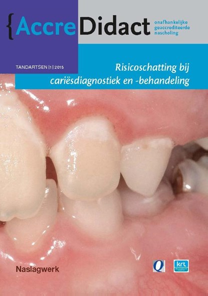 Risicoschatting bij cariësdiagnostiek en -behandeling gebaseerd op risicoschatting, Cor van Loveren ; Gert Stel - Paperback - 9789089761781