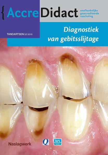 Diagnostiek van gebitsslijtage, Peter Wetselaar ; Frank Lobbezoo - Paperback - 9789089761866