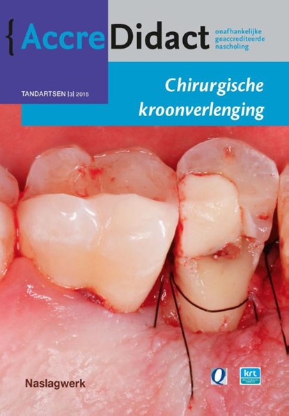 Chirurgische kroonverlenging, S. Paraskevas - Paperback - 9789089761958