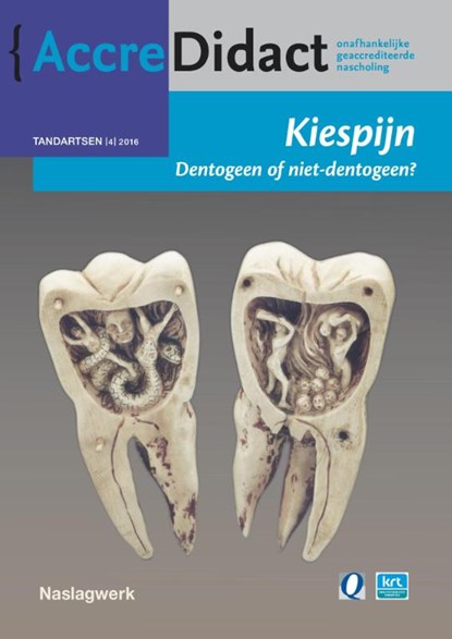 Kiespijn, dentogeen of niet-dentogeen?, Jan Warnsinck - Paperback - 9789089762276