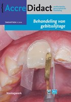 Behandeling van gebitsslijtage | Peter Wetselaar ; Bas Loomans ; Niek Opdam ; Frank Lobbezoo | 