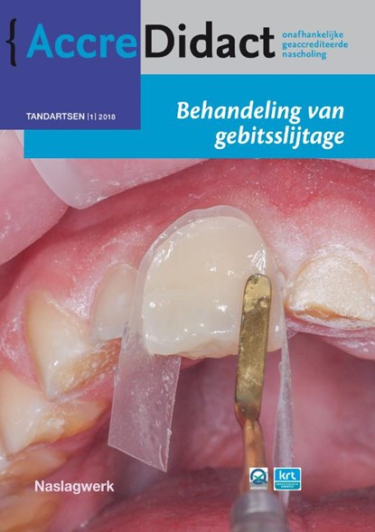 Behandeling van gebitsslijtage, Peter Wetselaar ; Bas Loomans ; Niek Opdam ; Frank Lobbezoo - Paperback - 9789089762771