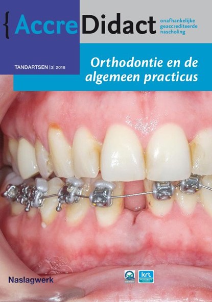 Orthodontie en de algemeen practicus, Nicoline van der Kaaij - Paperback - 9789089762931