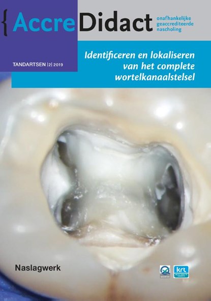Identificeren en lokaliseren van het complete wortelkanaalstelsel, Michael Drefs - Paperback - 9789089763198