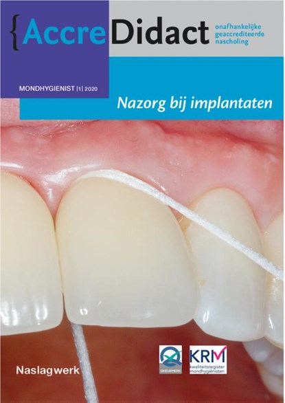 Nazorg bij implantaten Mondhygiënist 2020-1, Gordon van der Avoort ; Erik Blom - Paperback - 9789089763563
