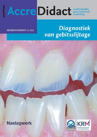 Diagnostiek van gebitsslijtage, Peter Wetselaar ; Frank Lobbezoo - Paperback - 9789089763785