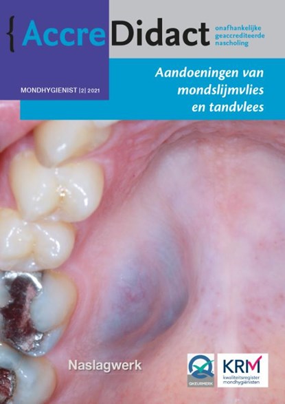 Aandoeningen van mondslijmvlies en tandvlees, Isaäc van der Waal - Paperback - 9789089763884