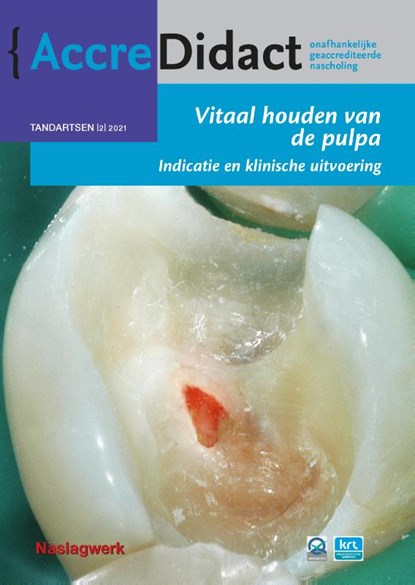 Vitaal houden van de pulpa, Till Dammaschke ; Georg Benjamin - Paperback - 9789089763969