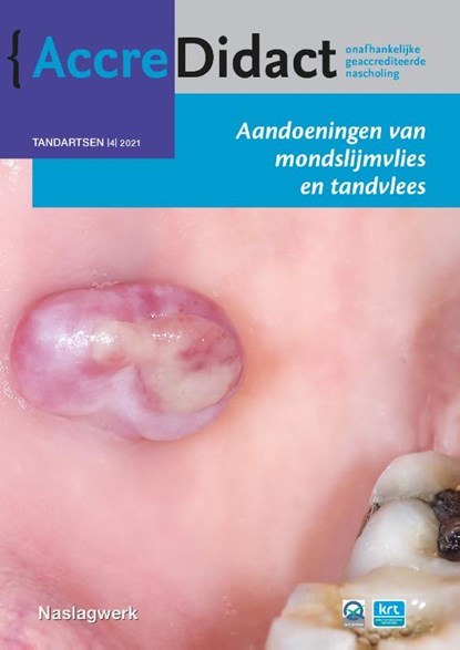 Aandoeningen van mondslijmvlies en tandvlees, Isaäc van der Waal - Paperback - 9789089764096