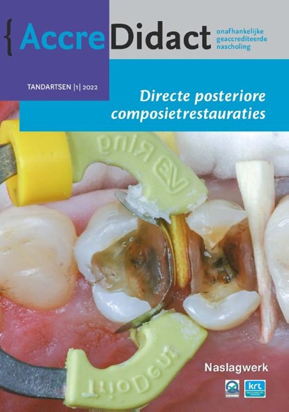 Directe posteriore composietrestauraties, Bas Loomans ; Niek Opdam - Paperback - 9789089764300