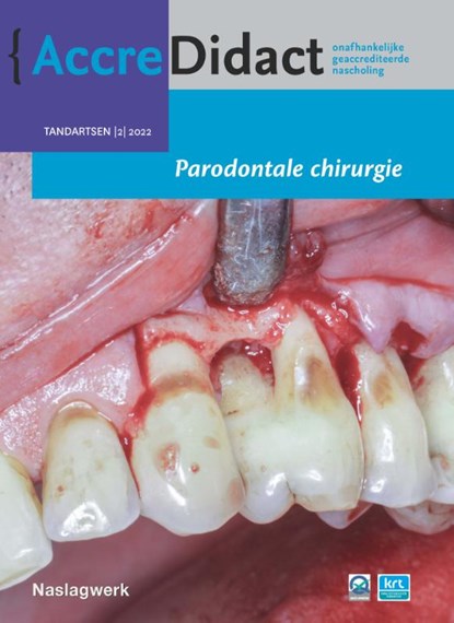 Parodontale chirurgie, Alexander Verhelst - Paperback - 9789089764577
