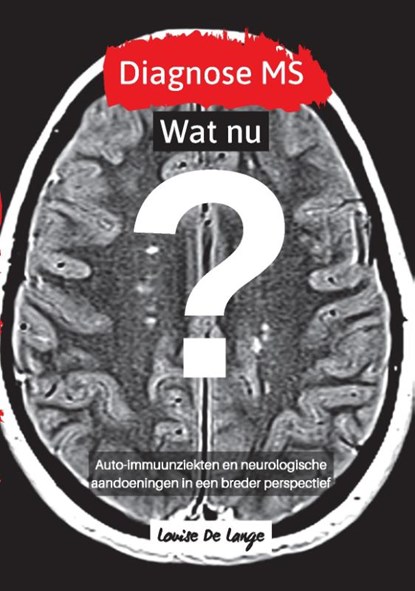 Diagnose MS Wat nu?, Louise De Lange - Paperback - 9789090320908
