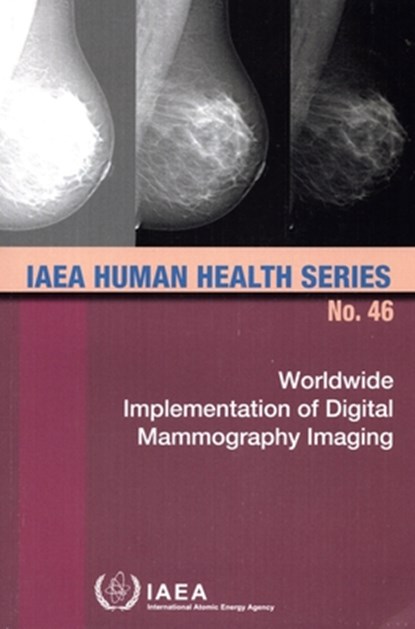 Worldwide Implementation of Digital Mammography Imaging, International Atomic Energy Agency - Paperback - 9789201267238