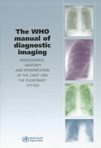 The Who Manual of Diagnostic Imaging: Radiographic Anatomy and Interpretation of the Chest, S. M. Ellis - Paperback - 9789241546775