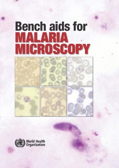 Bench AIDS for Malaria Microscopy, World Health Organization - Paperback - 9789241547864
